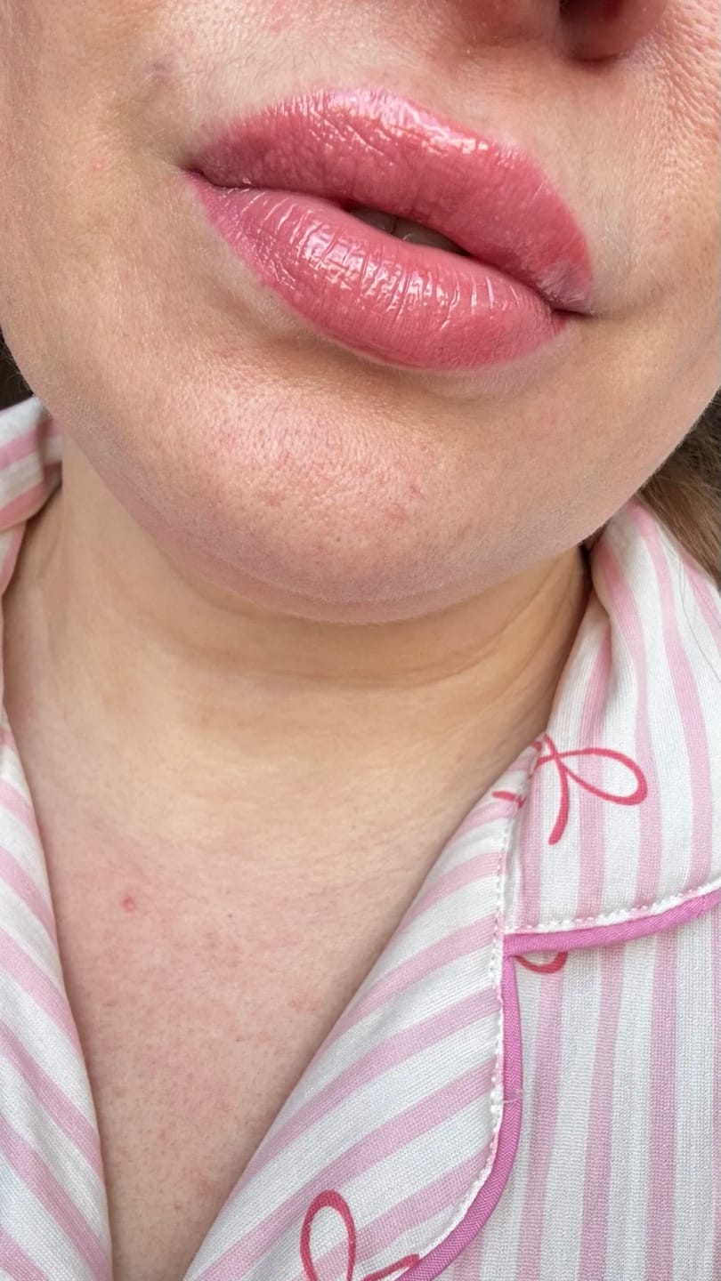 Customer photo review of Crystal Moisturizing Tinted Lip Balm