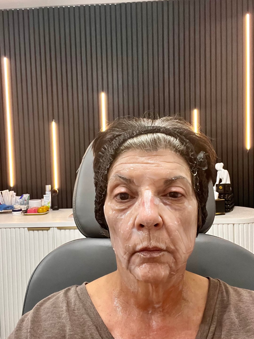 Customer photo review of HEDOSOMES Lyophilized MSC-Derived Complex Microneedling Kit