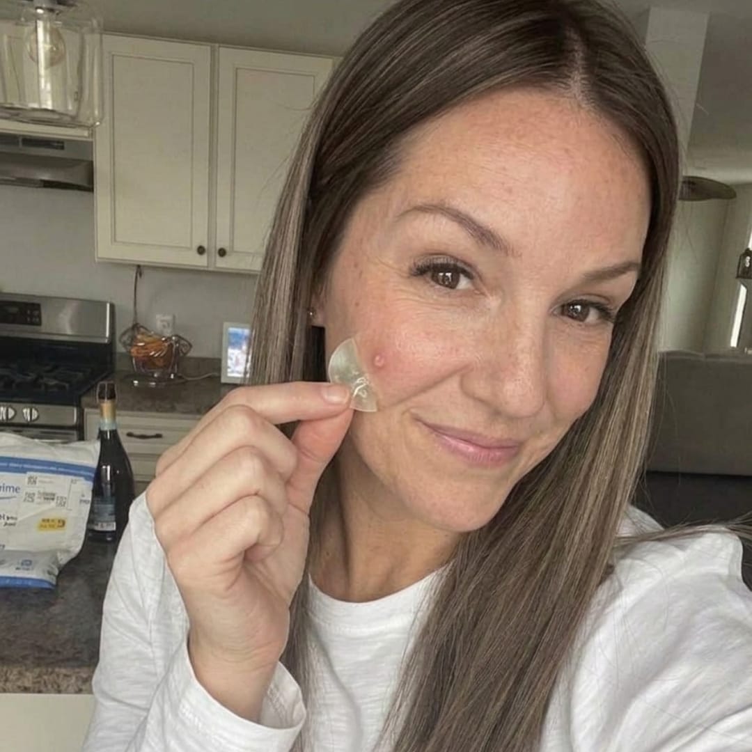Customer photo review of Dermozzis Apósito Corrector Hidrocoloide.