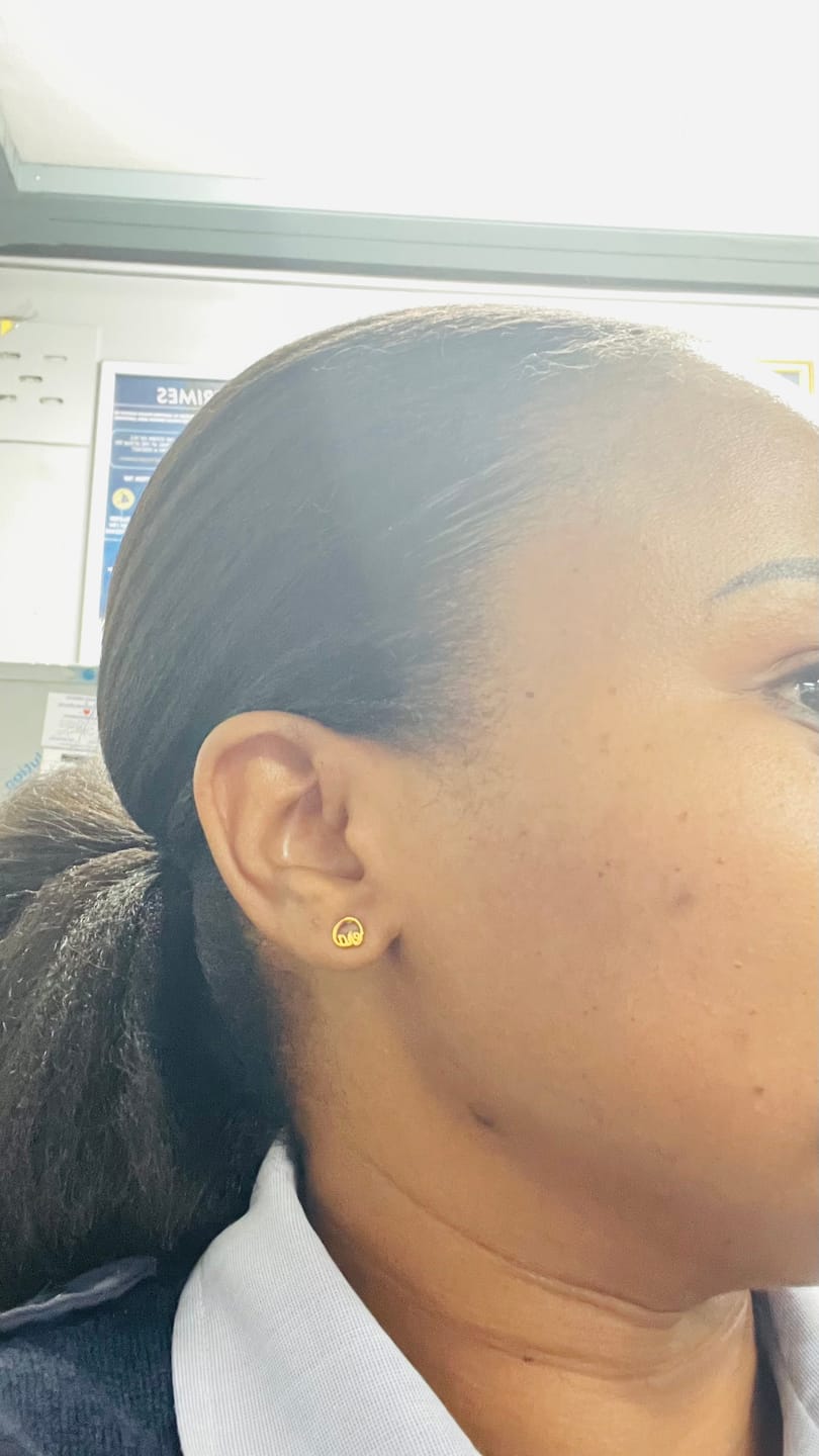 Customer photo review of Mini Era Logo Studs