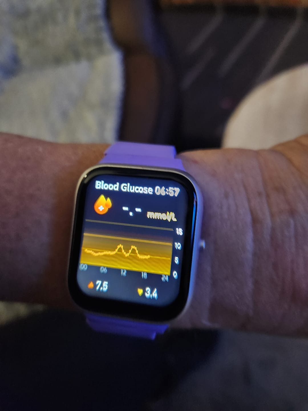 Customer photo review of BEARSCOME Blood Pressure Blood oxygen Blood Sugar Monitoring Bluetooth Talk Play Music Health Waterproof Smartwatch