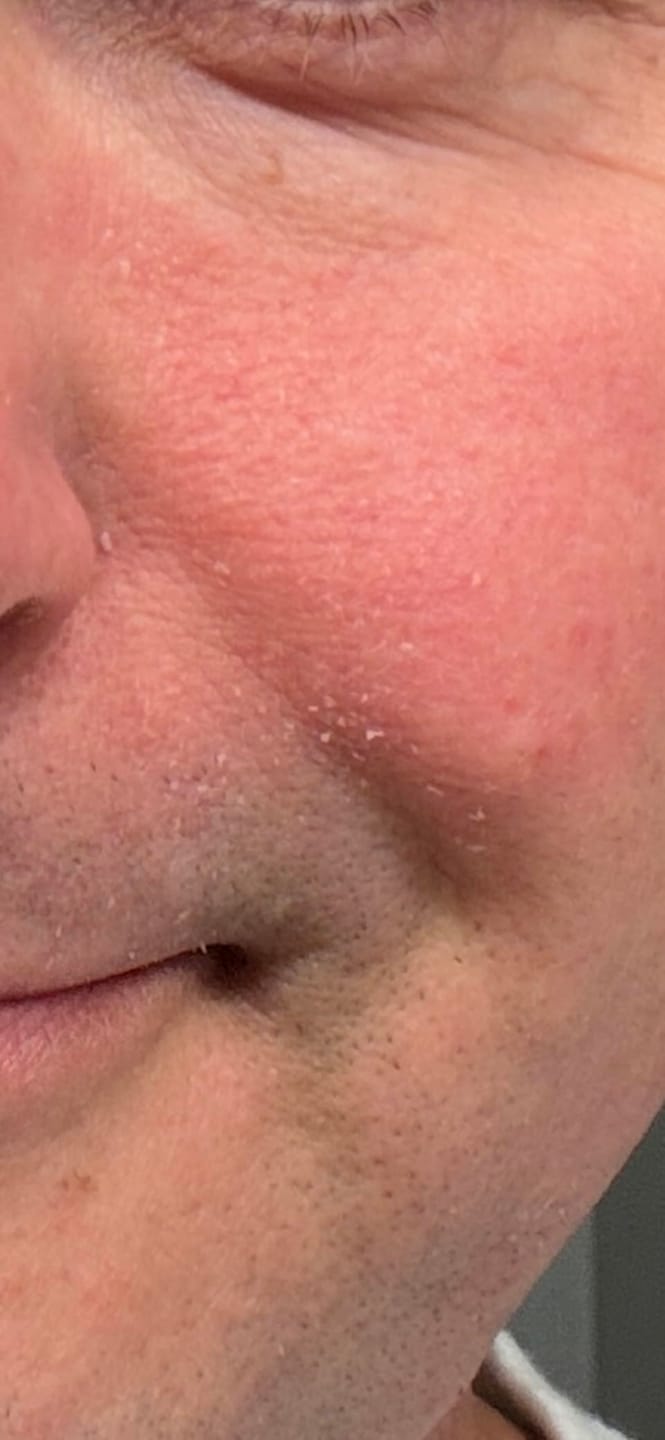 Customer photo review of Cutagen - Crema Recuperación Barba