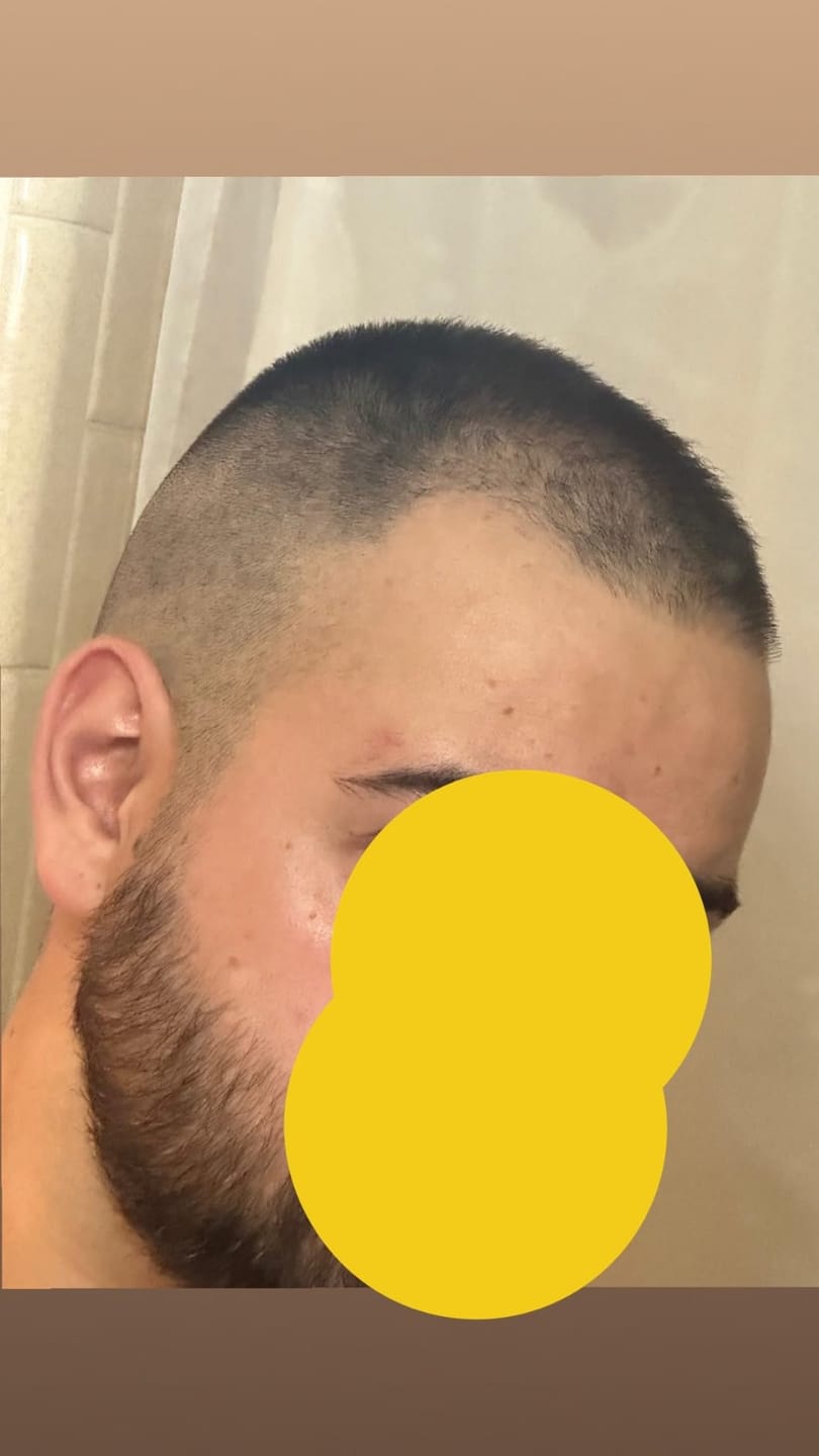 Customer photo review of Fadify 2.0