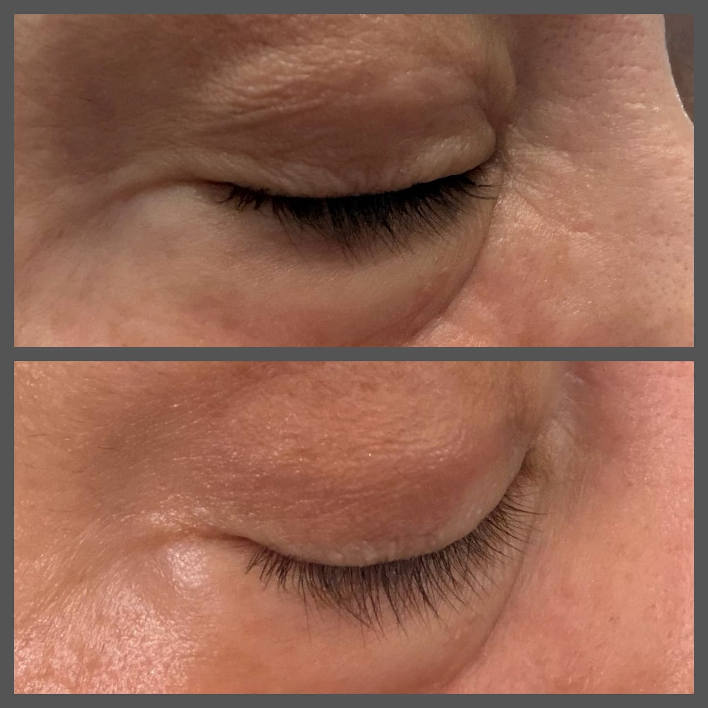 Customer photo review of Bag Drop Under Eye Cream Gel