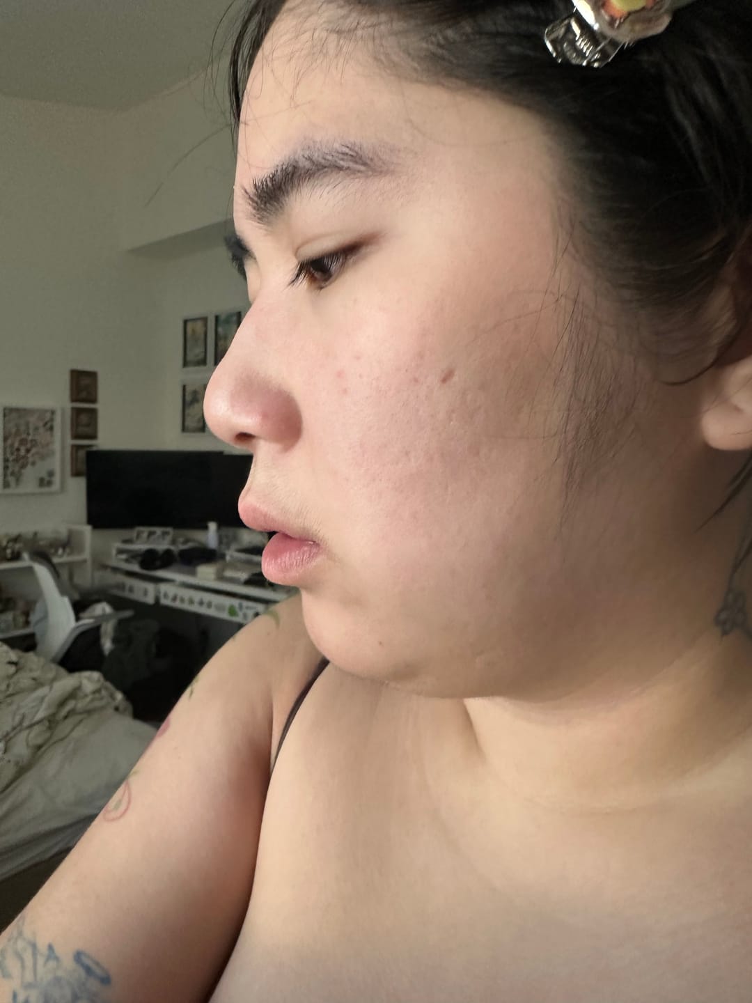 Customer photo review of Blue EGF Intensive Pro Cream