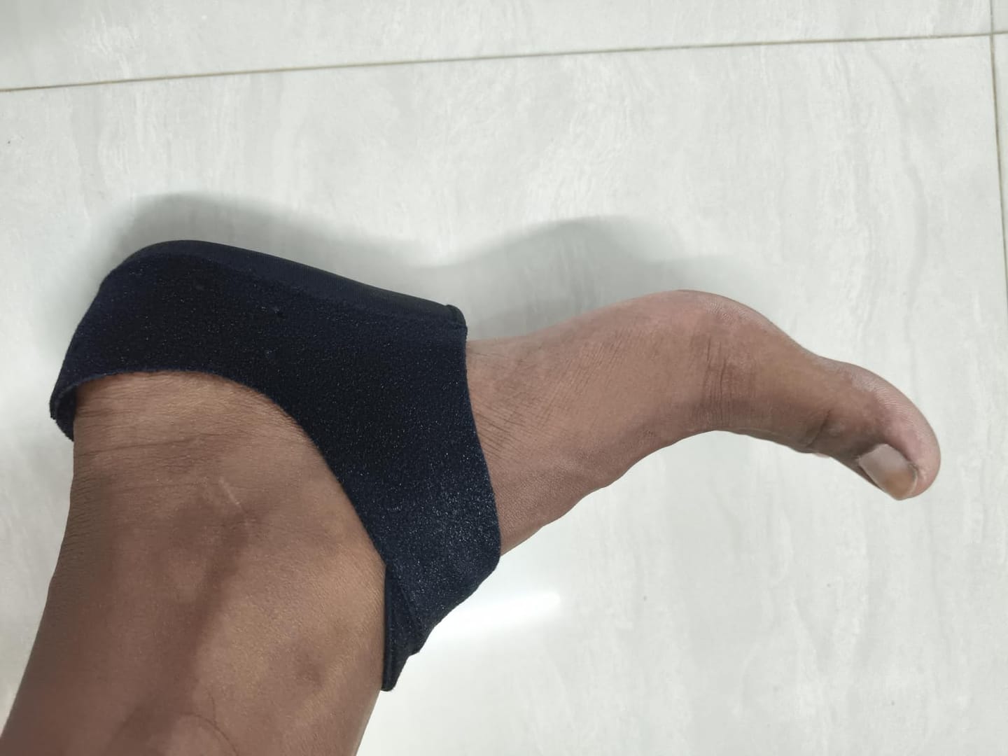 Customer photo review of Heel Protectors
