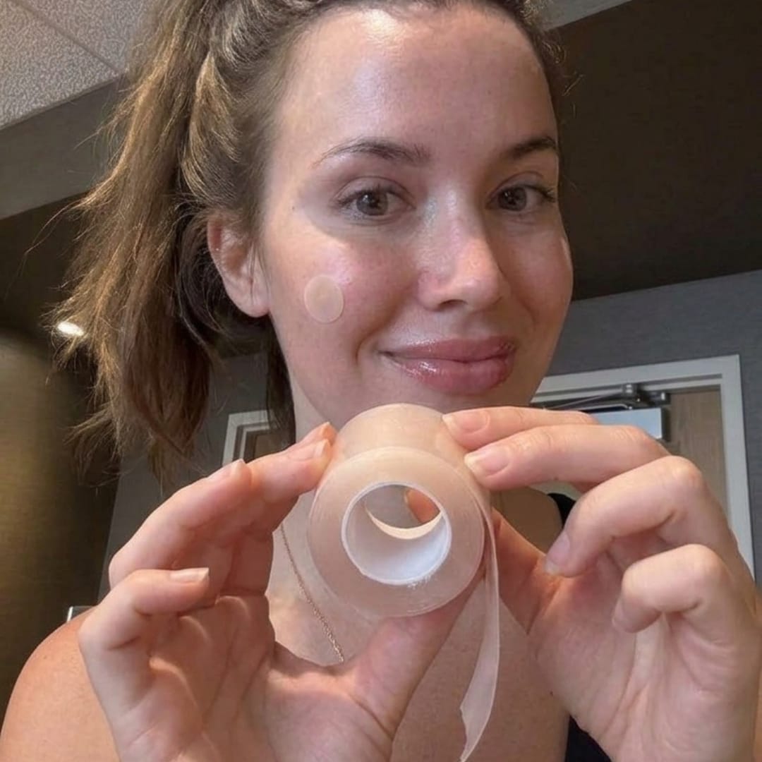 Customer photo review of Dermozzis Apósito Corrector Hidrocoloide.