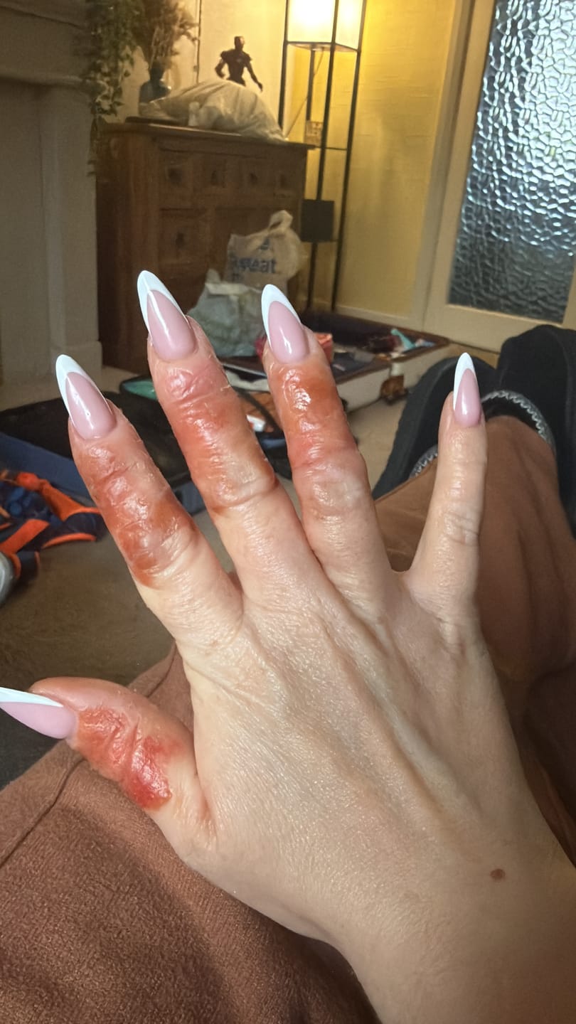 Customer photo review of Bioskin Duo Pack