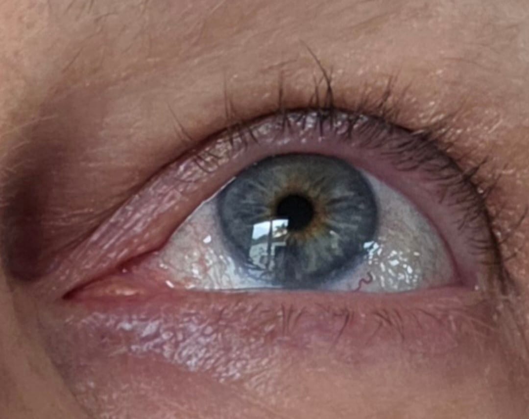 Customer photo review of Enhance® - Eyelash Growth Serum