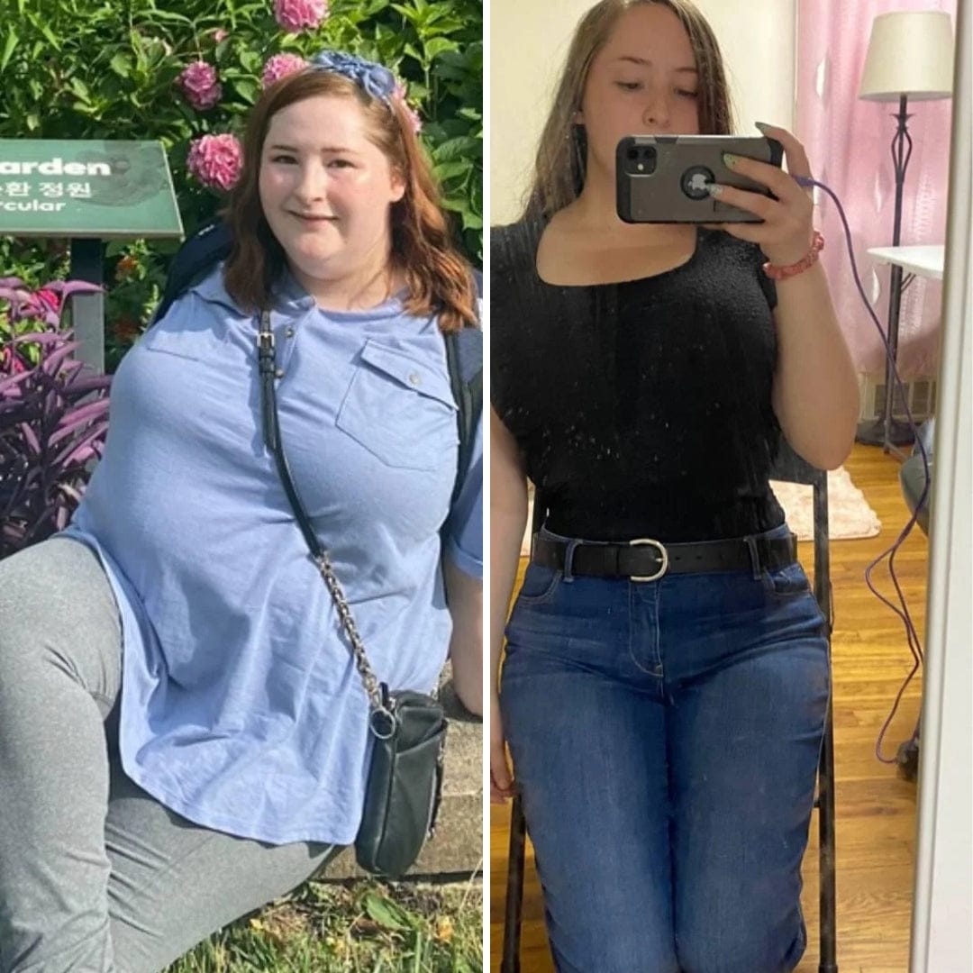 Customer photo review of Parches de berberina (GLP-1) 3 en 1 - Reduce hasta 8kg en 90 días de forma natural