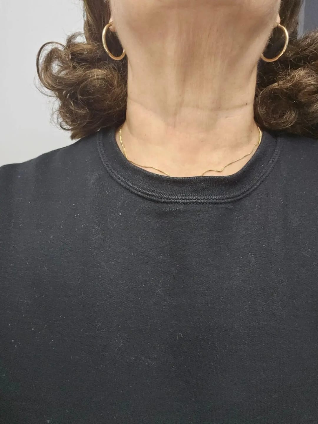 Customer photo review of Masajeador Facial LED Auvran™