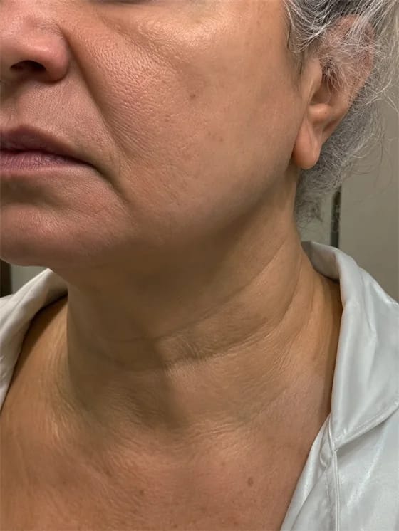 Customer photo review of Masajeador Facial cara y cuello