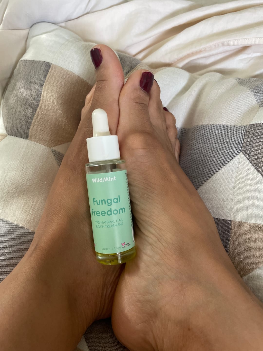 Customer photo review of Fungal Freedom