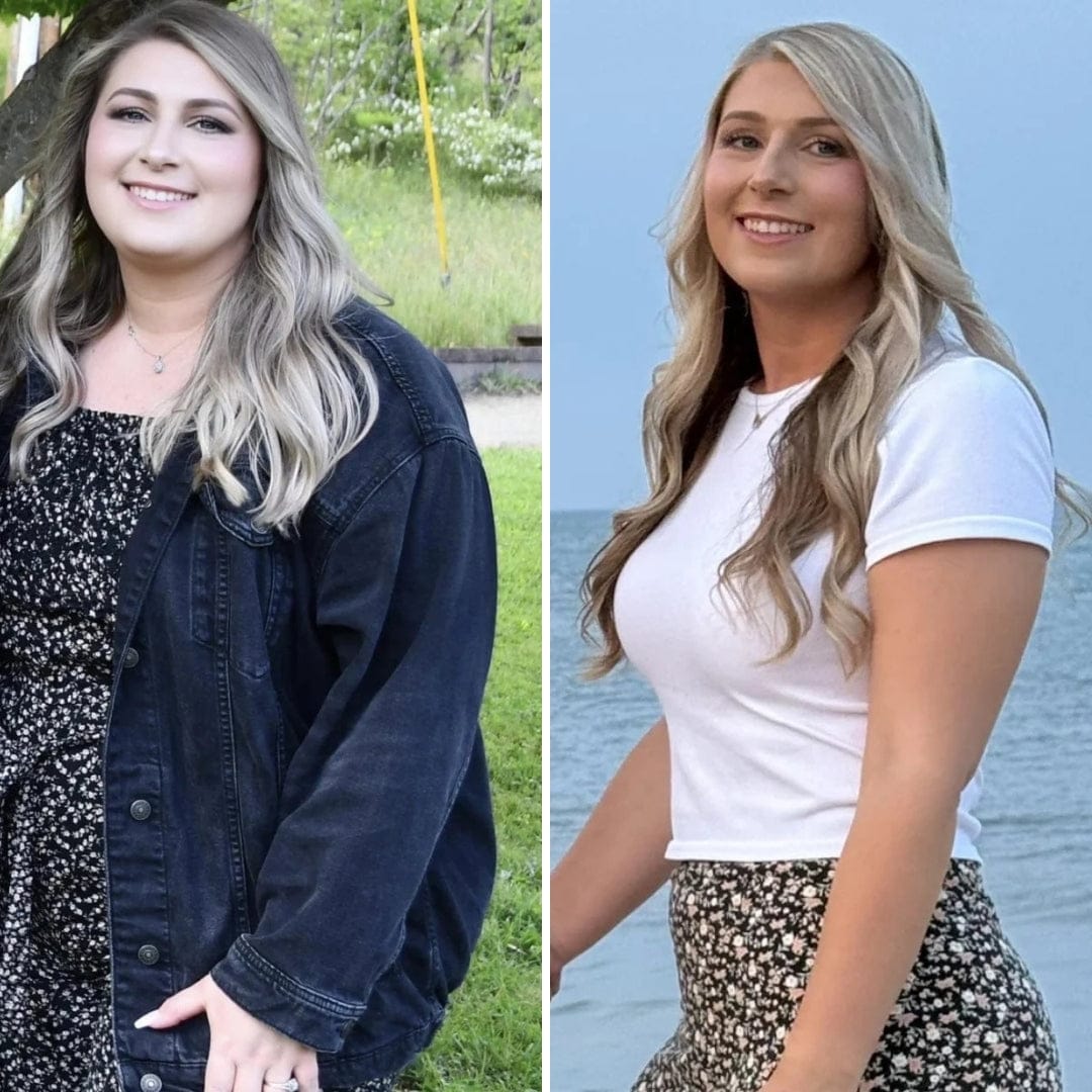 Customer photo review of Parches de berberina (GLP-1) 3 en 1 - Reduce hasta 8kg en 90 días de forma natural