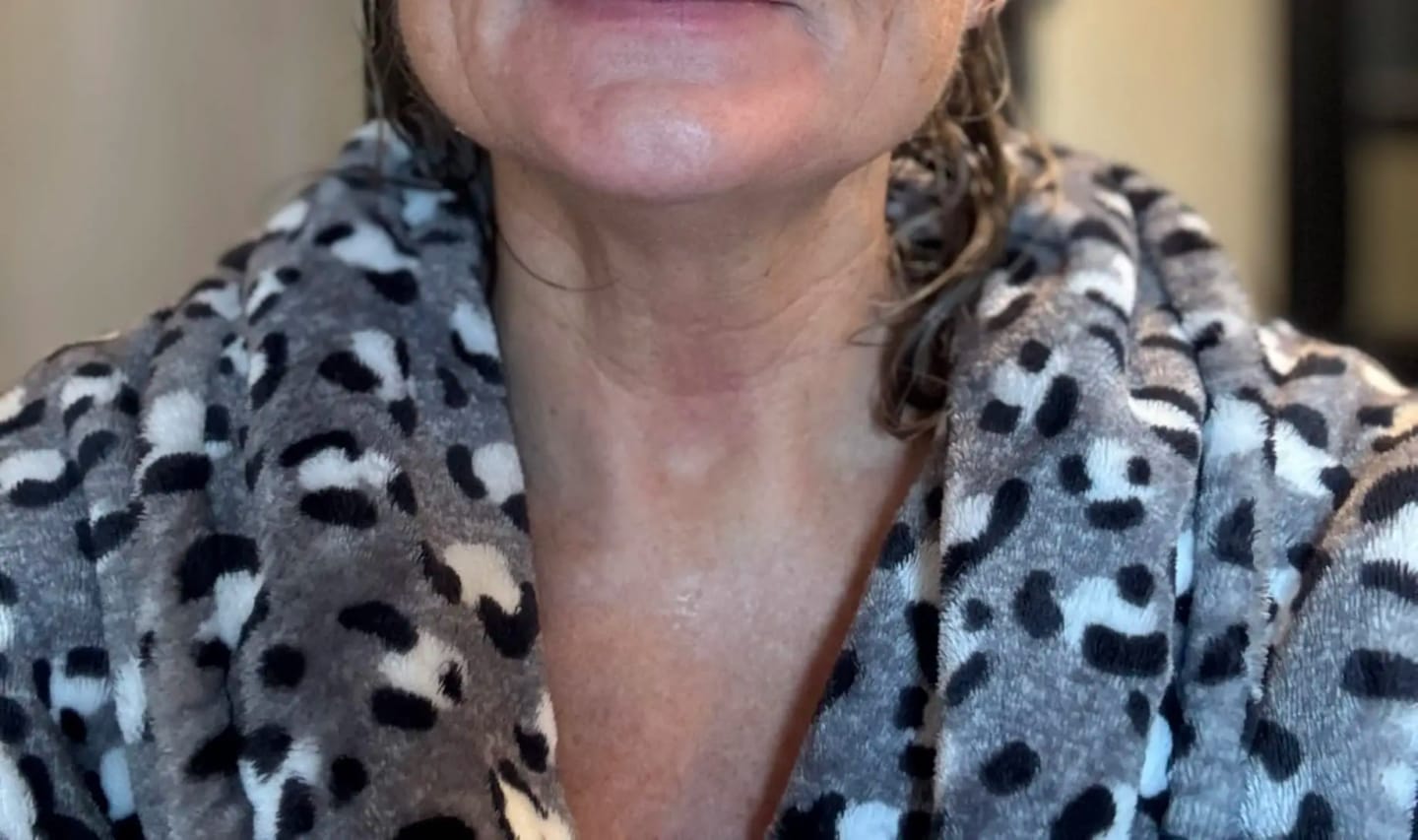 Customer photo review of Masajeador Facial LED Auvran™