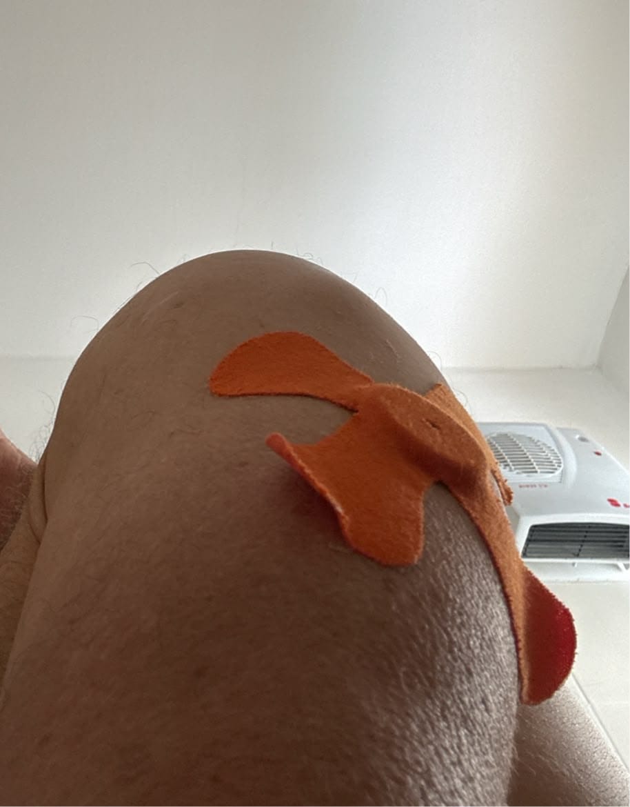 Customer photo review of X- Patch כתום 20 יח׳