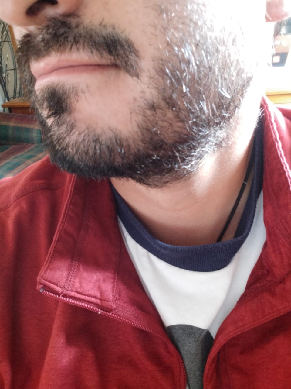 Customer photo review of Minoxidil 5 mg con 90 tabletas para 3 meses de tratamiento