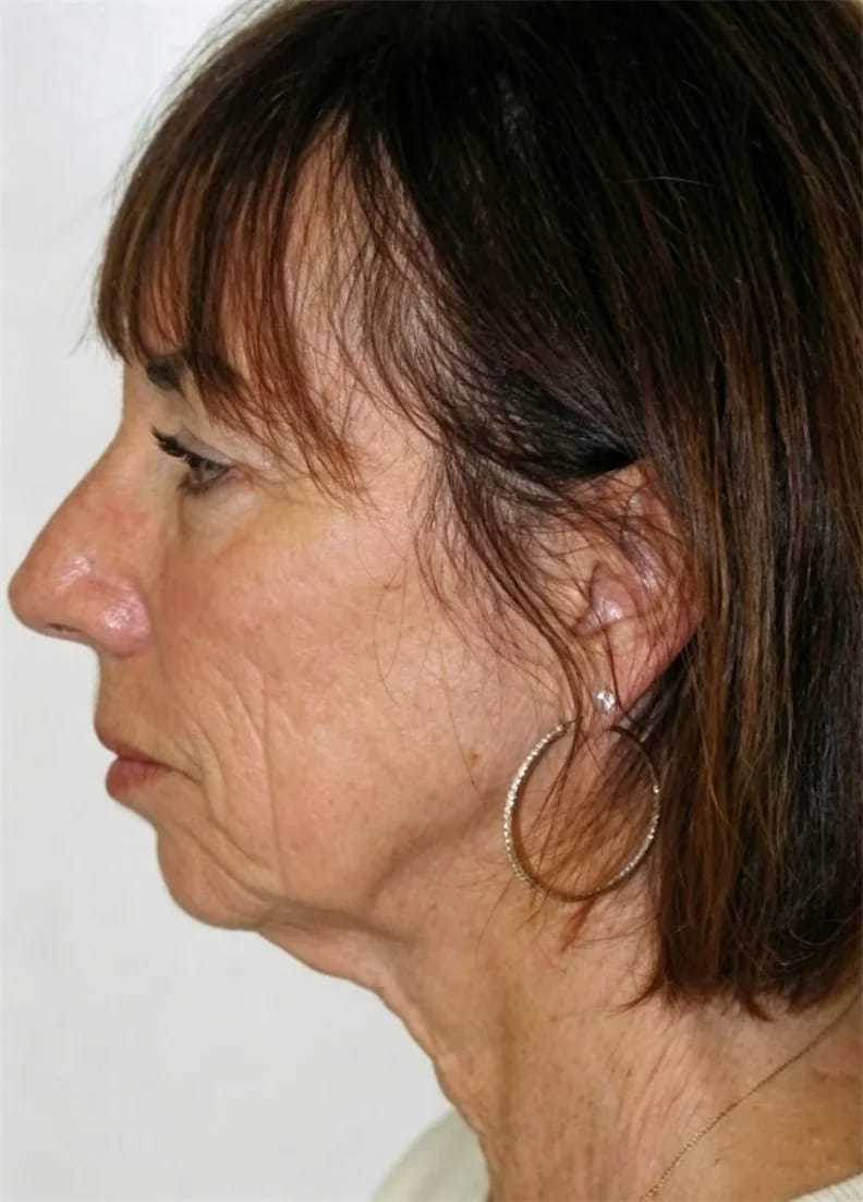Customer photo review of Masajeador Facial cara y cuello