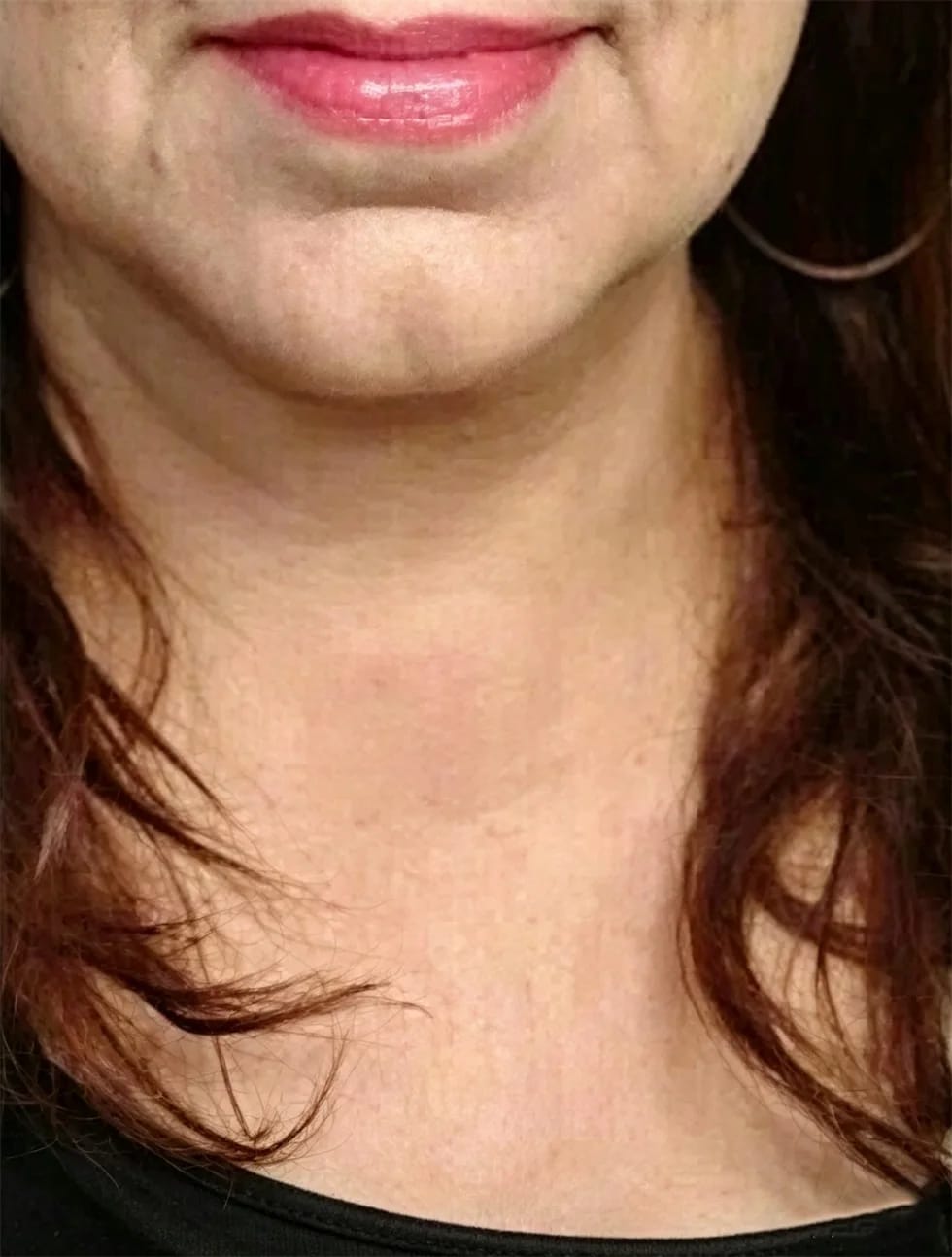 Customer photo review of Masajeador Facial LED Auvran™