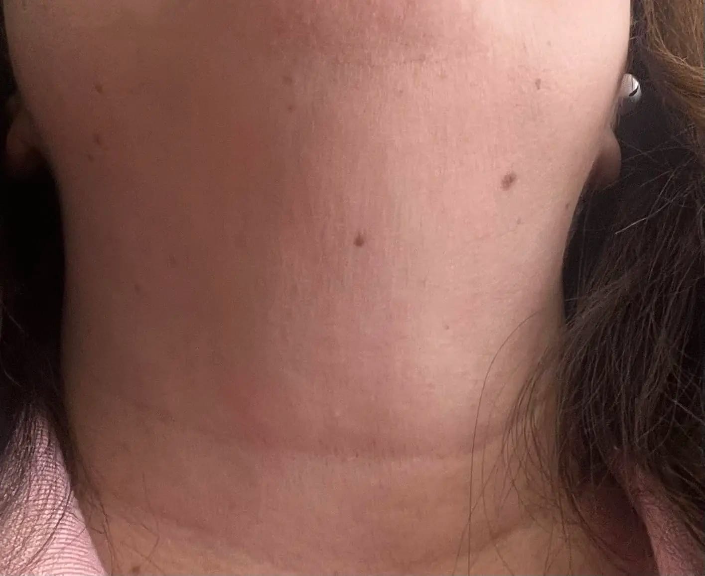 Customer photo review of Masajeador Facial cara y cuello
