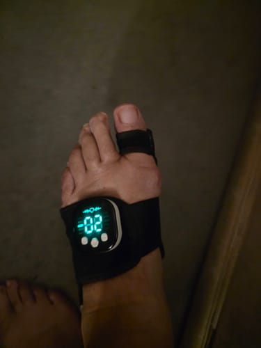 Customer's black Nexalign Pro EMS Bunion Corrector worn on a foot, with a glowing green digital display showing the number 02.