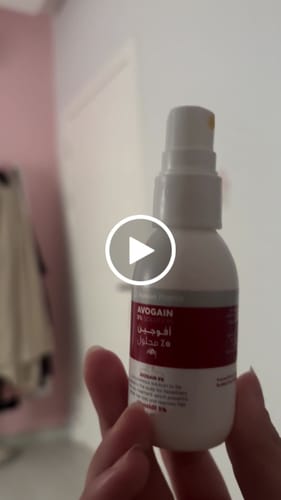 مراجعة بالفيديو من عميل لمنتج Avalon Pharma Avogen 5% Hair Growth Spray for Men – 50 ml