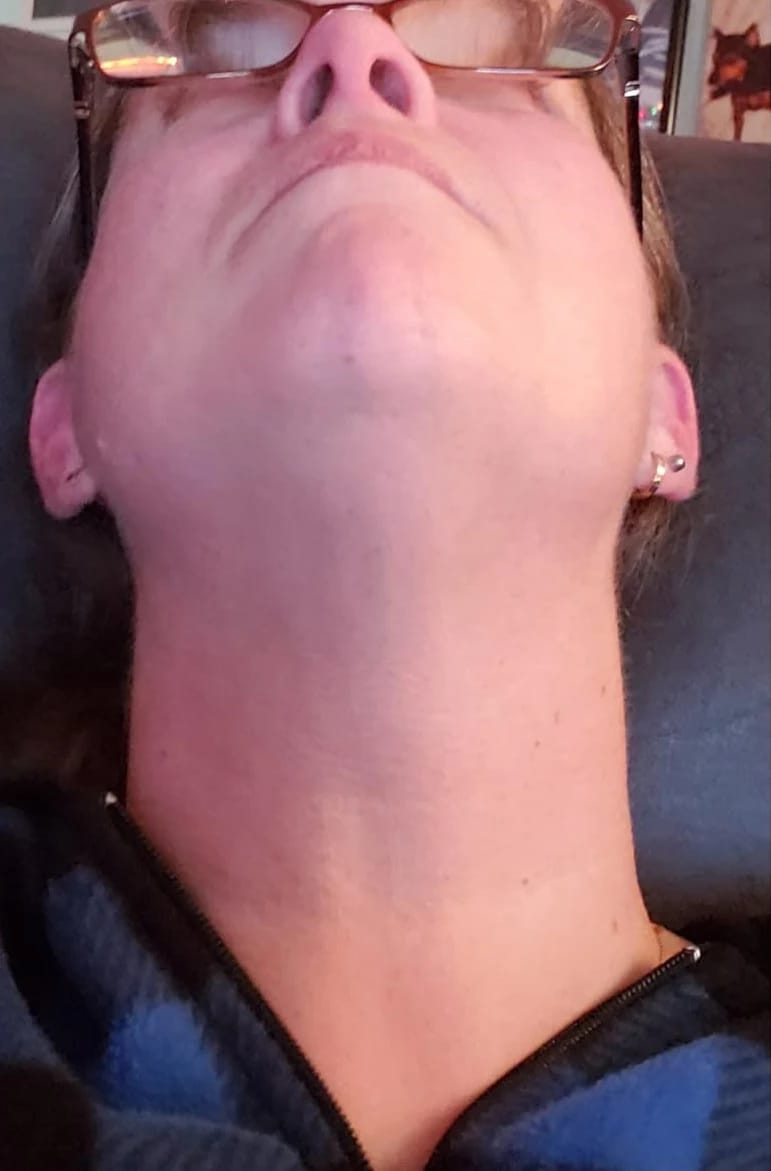 Customer photo review of Masajeador Facial LED Auvran™