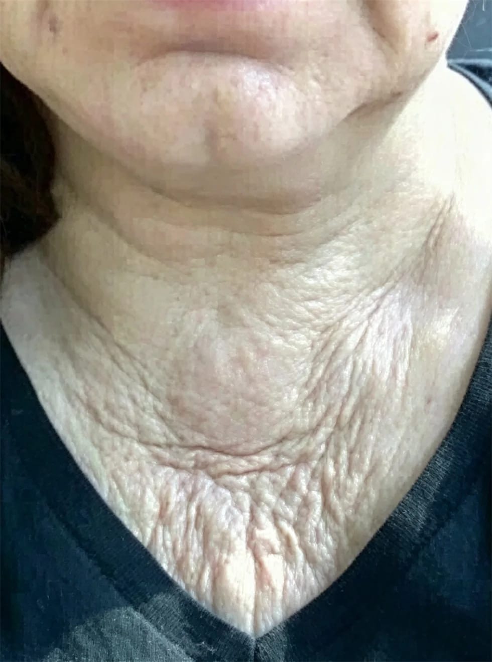 Customer photo review of Masajeador Facial cara y cuello
