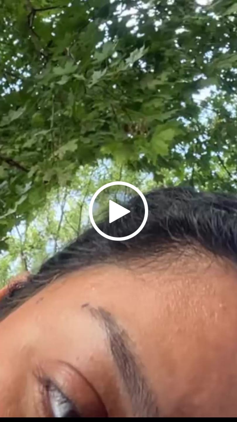 Customer video review of fLASH EYELASH SERUM