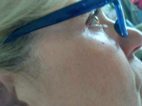 Customer photo review of LED Face Mask | Medical Grade LED's