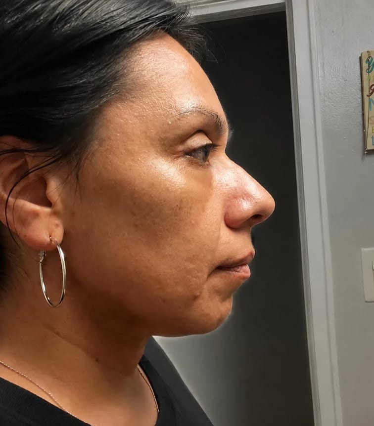 Customer photo review of Masajeador Facial cara y cuello