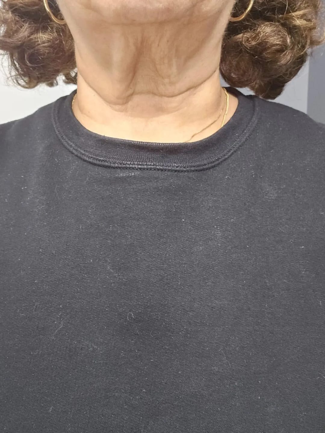 Customer photo review of Masajeador Facial cara y cuello