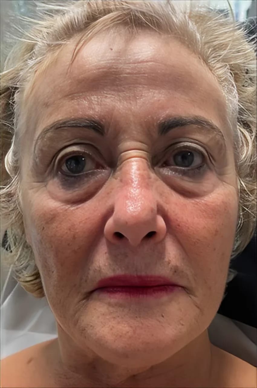 Customer photo review of Masajeador Facial cara y cuello