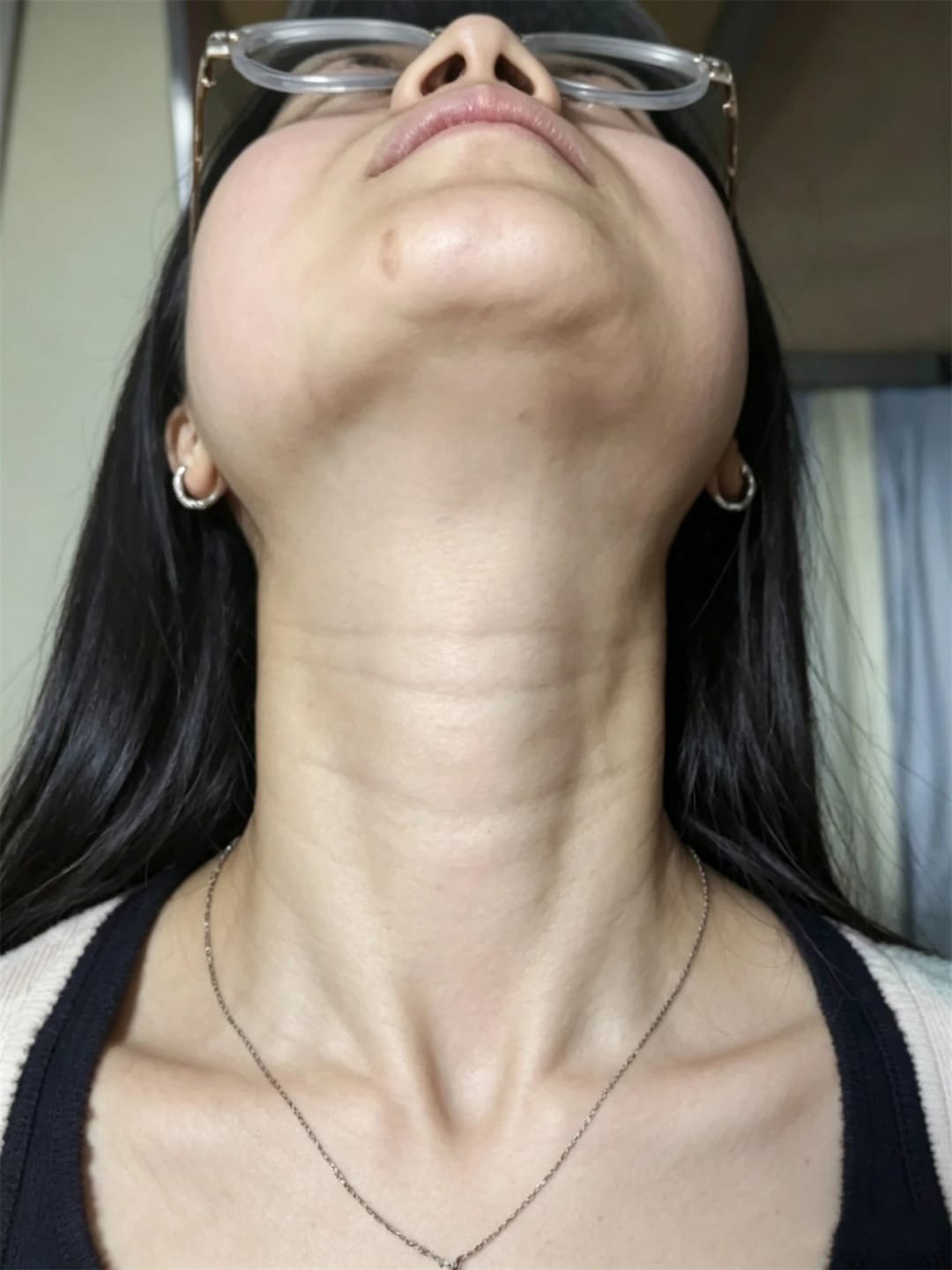 Customer photo review of Masajeador Facial cara y cuello