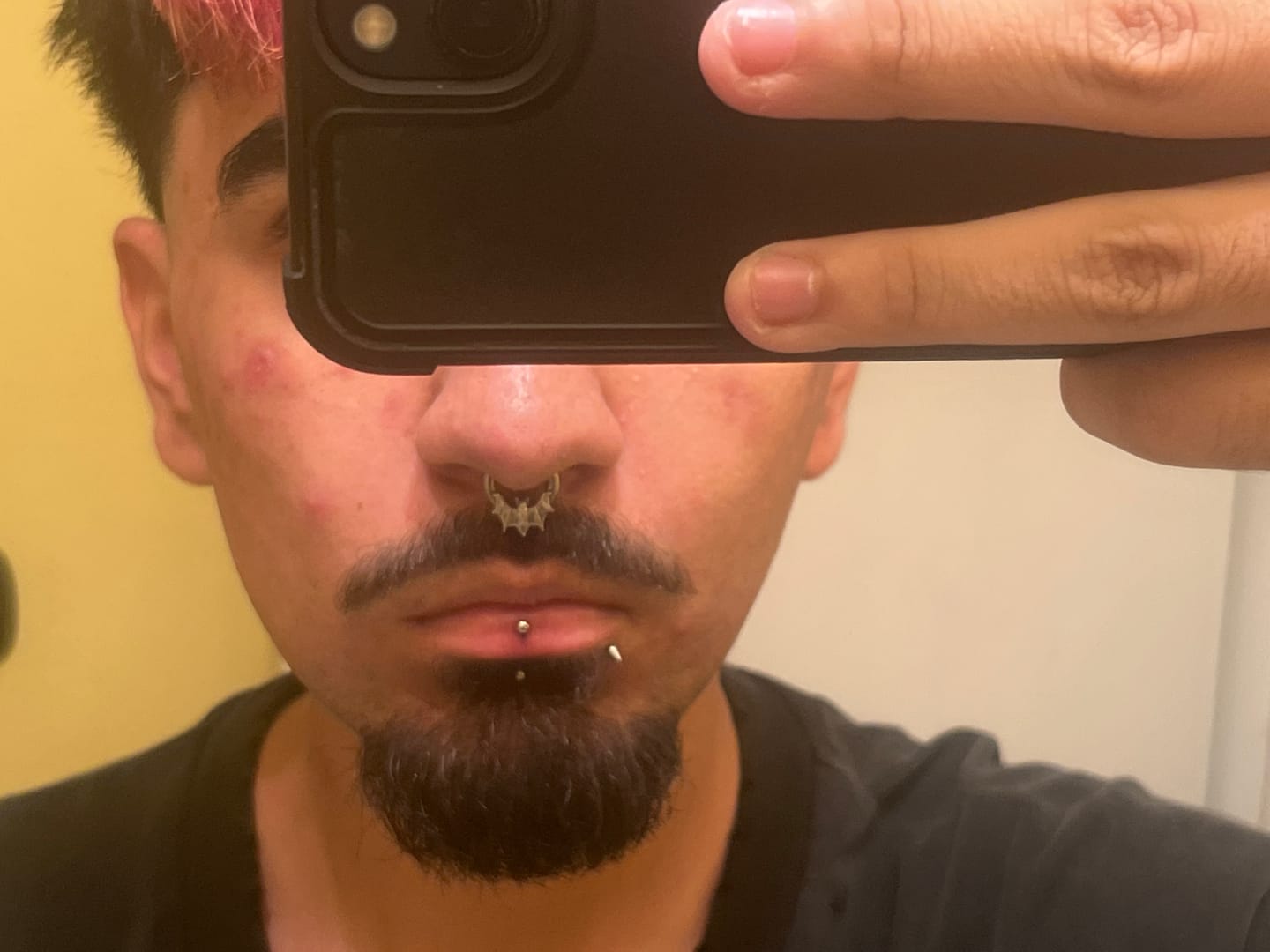 Customer photo review of BAT SEPTUM