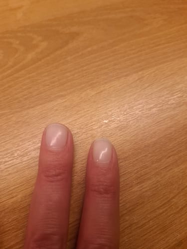 Kunden-Foto der UV Gel Babyboomer Nail Wraps nach zwei Wochen Tragezeit, zwei gepflegte Fingernägel in Nahaufnahme.