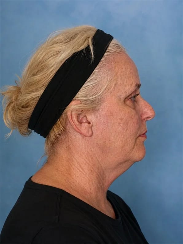 Customer photo review of Masajeador Facial cara y cuello