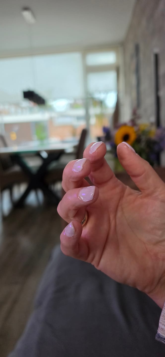 Customer photo review of Glowdip Alles-in-één Manicure Set