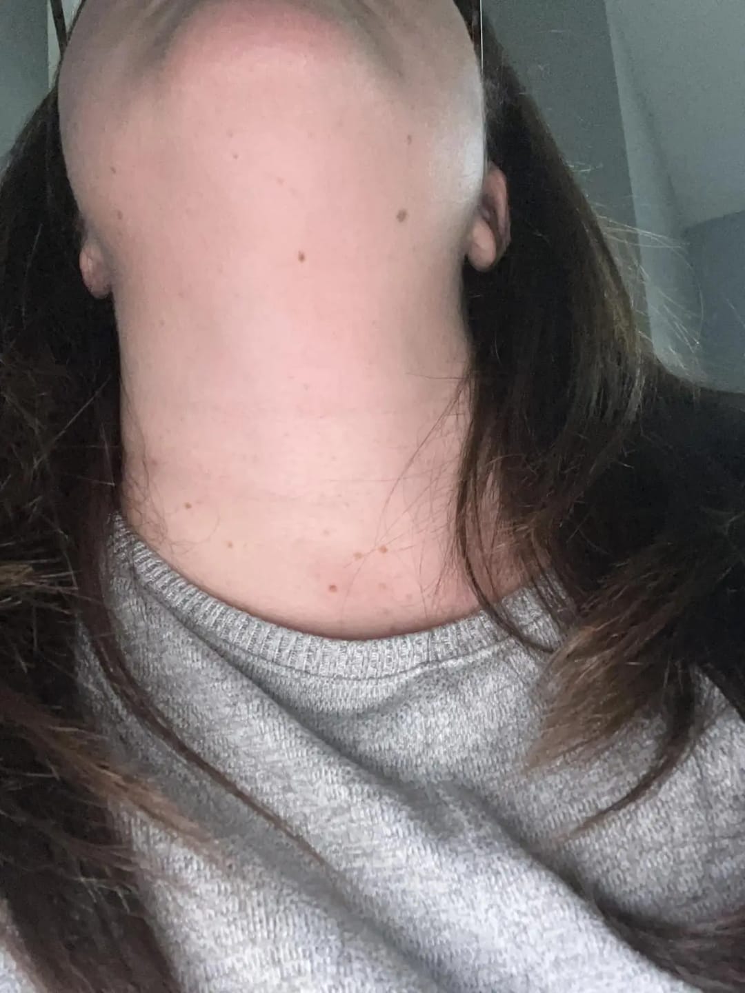 Customer photo review of Masajeador Facial LED Auvran™