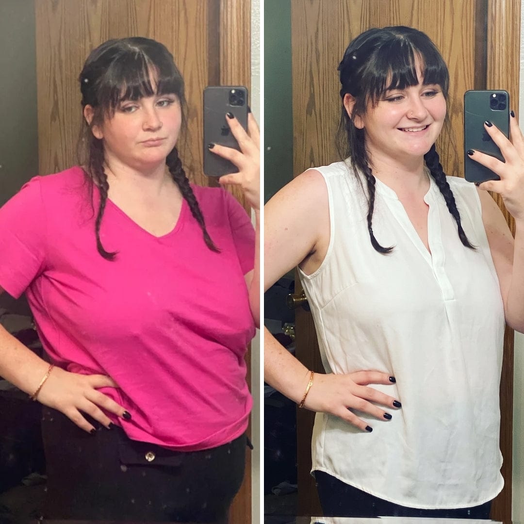 Customer photo review of Parches de berberina (GLP-1) 3 en 1 - Reduce hasta 8kg en 90 días de forma natural