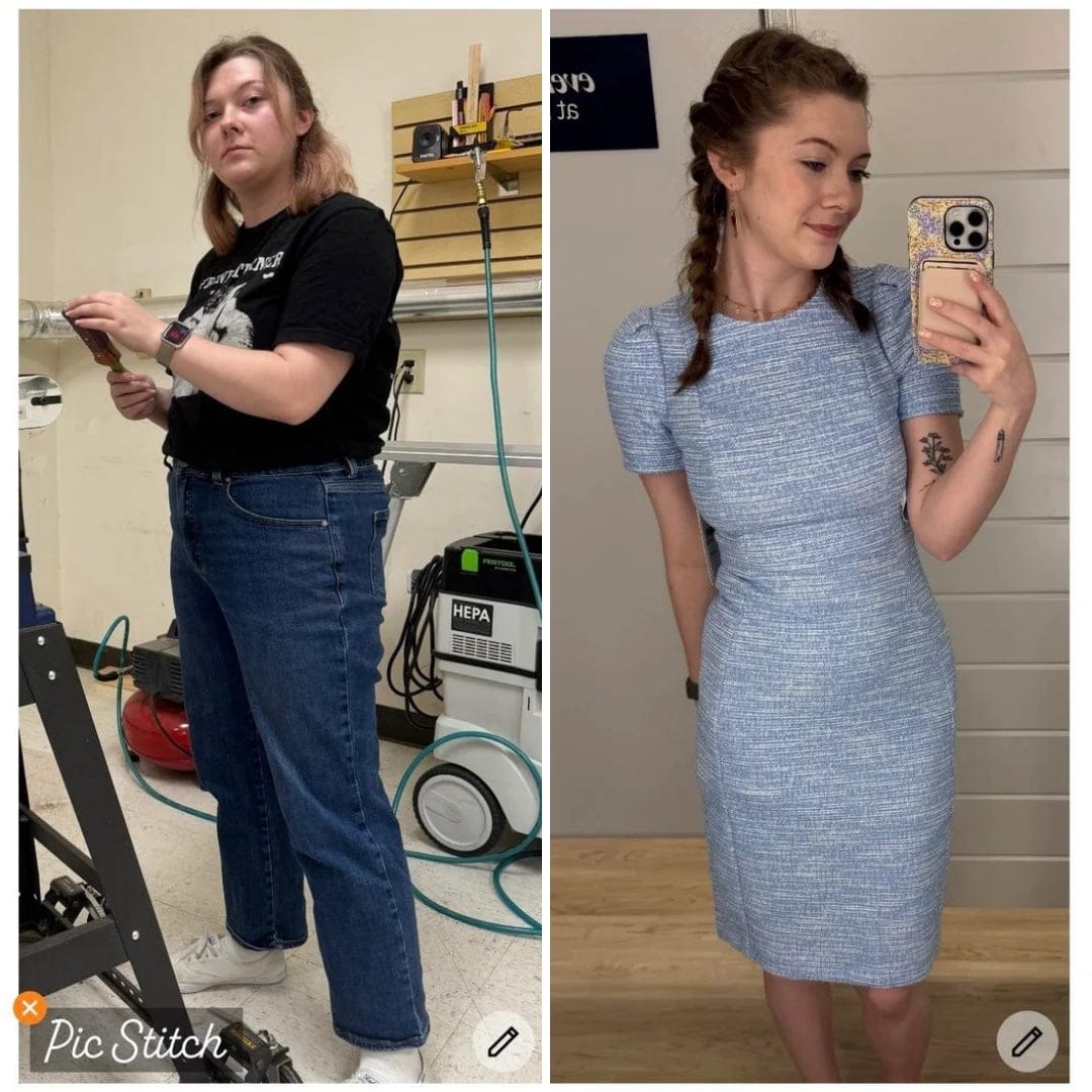 Customer photo review of Parches de berberina (GLP-1) 3 en 1 - Reduce hasta 8kg en 90 días de forma natural