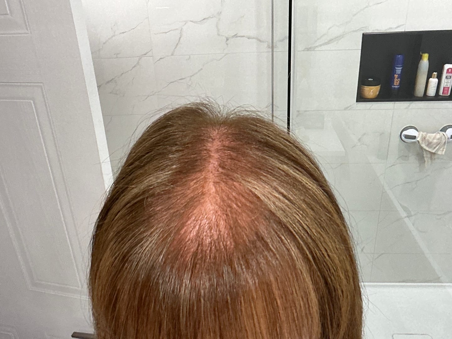 Customer photo review of Champô de Alecrim e Queratina para um Cabelo Mais Espesso