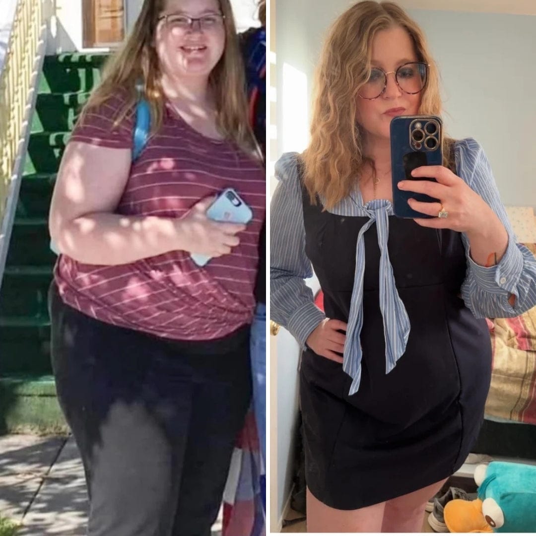 Customer photo review of Parches de berberina (GLP-1) 3 en 1 - Reduce hasta 8kg en 90 días de forma natural