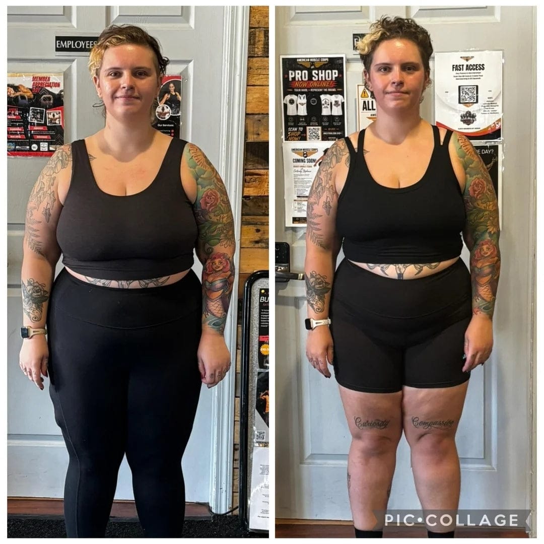 Customer photo review of Parches de berberina (GLP-1) 3 en 1 - Reduce hasta 8kg en 90 días de forma natural
