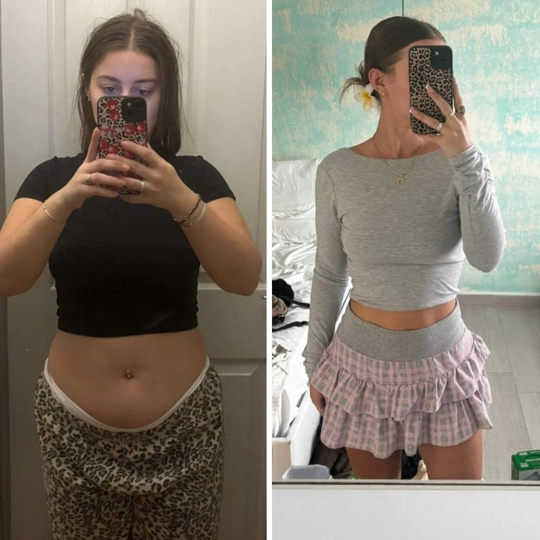 Customer photo review of Parches de berberina (GLP-1) 3 en 1 - Reduce hasta 8kg en 90 días de forma natural