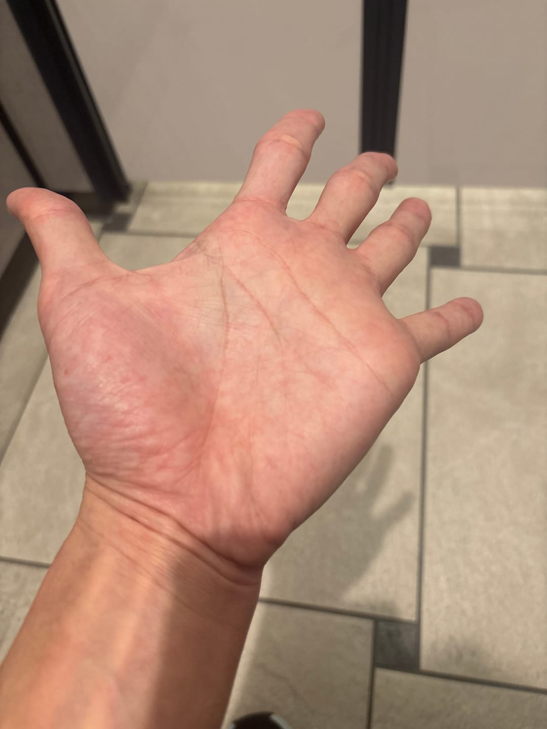 Customer photo review of クリスタルトマト®美白サプリメント【正規取扱店】