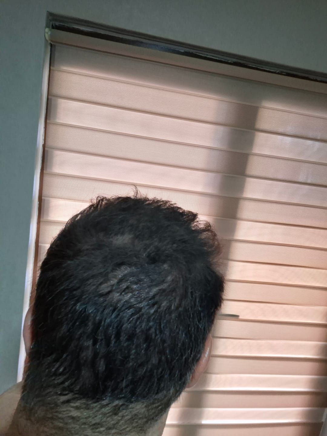 Customer photo review of Flxhair Saç tozu