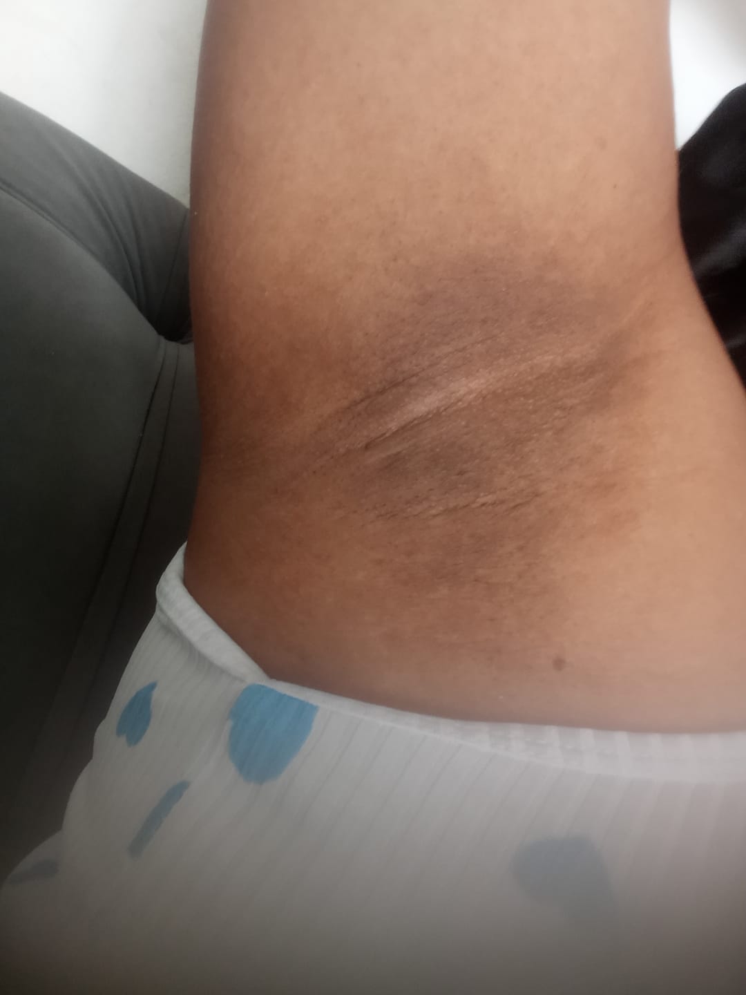 Customer photo review of Kit Clareamento Total + 1 Firmador de Brinde