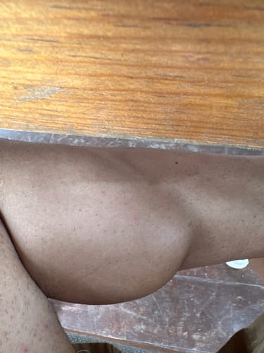 Customer's muscle definition captured in a close-up photo, suggesting physical progress after using Trenboplex.