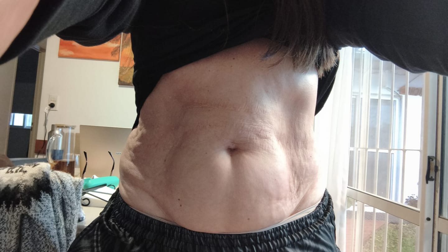 Customer photo review of Aceite Corporal Reafirmante - Combate Celulitis, Flacidez y Arrugas